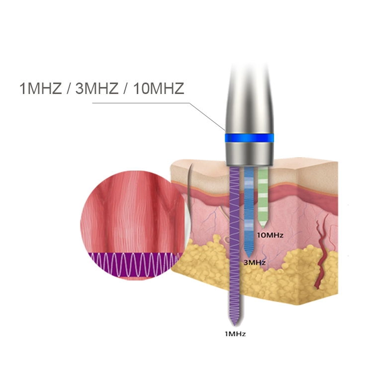 Ultraschall LDM Noblesse 10 MHz Therapie 3 in 1 Ultraschall Sin Wrinkle Remove Beauty Machine Gesichtspflegegeräte mit Hochfrequenz-Ultraschallwellen